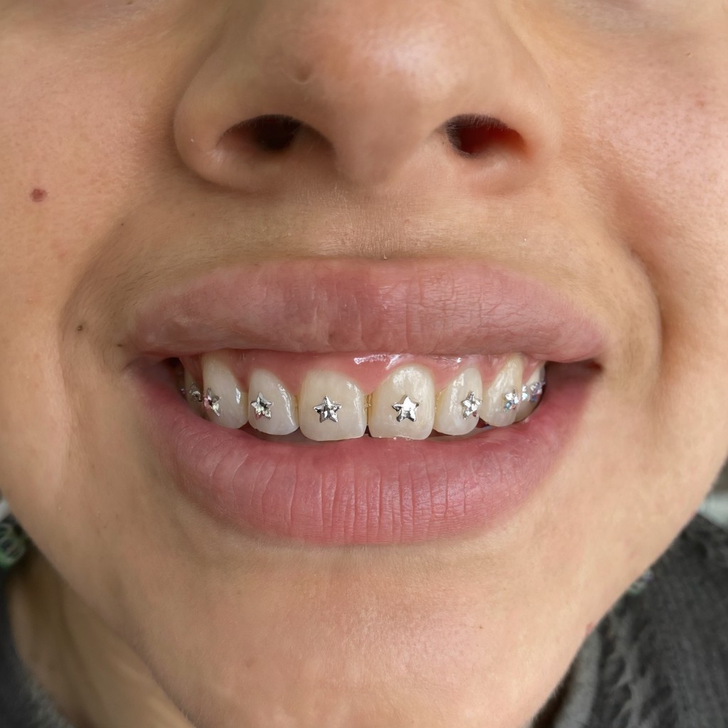 KHRYSOS™ Instalación